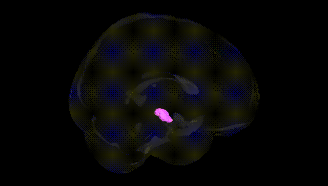 Full Brain Black