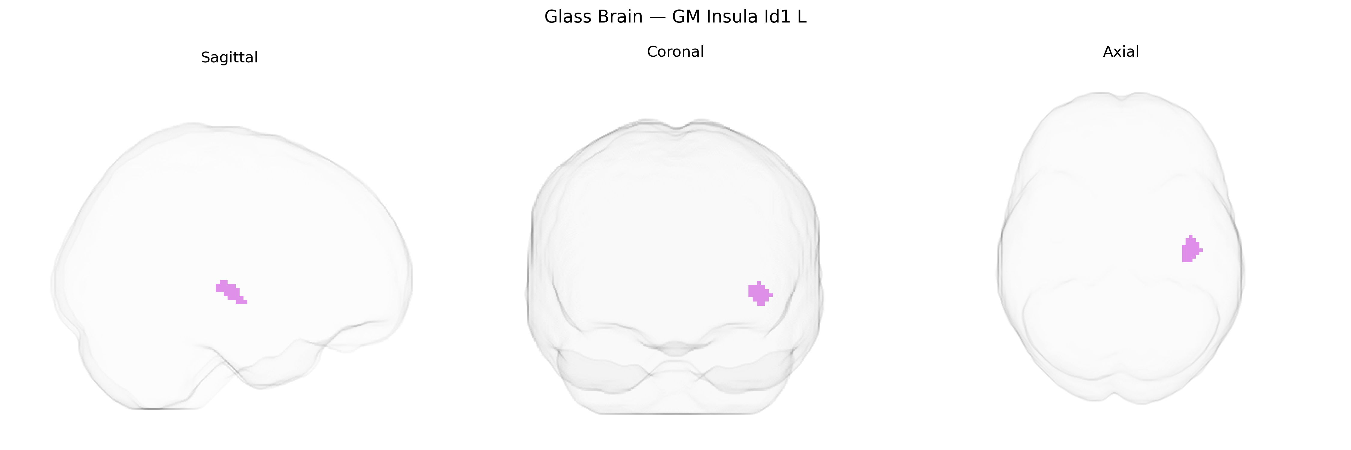 Triplanar Ghost Brain