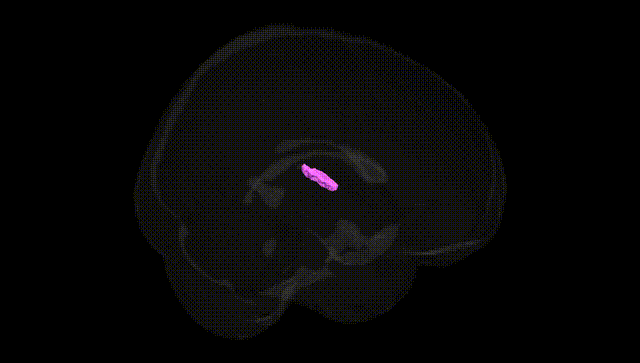 Full Brain Black