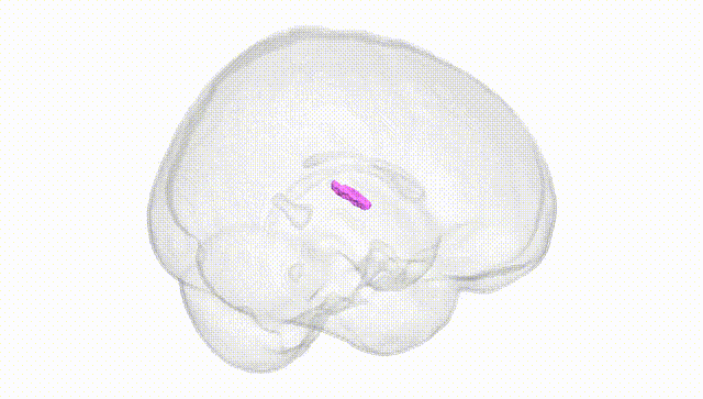 Full Brain White