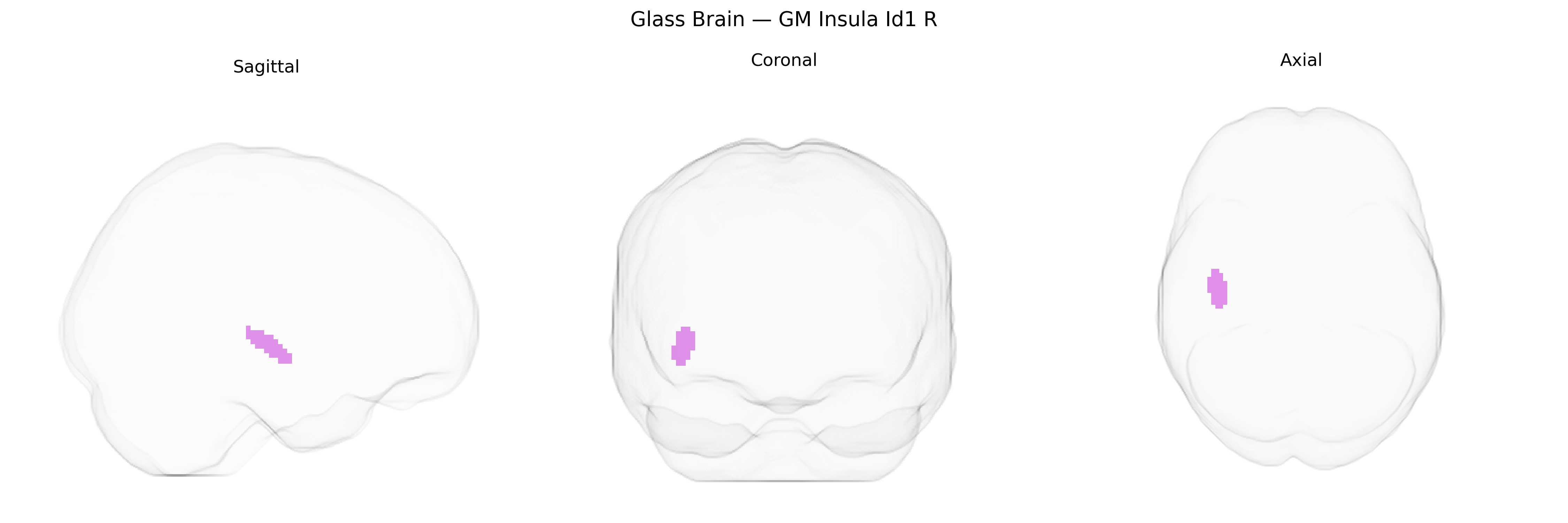 Triplanar Ghost Brain