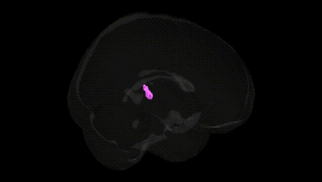 Full Brain Black
