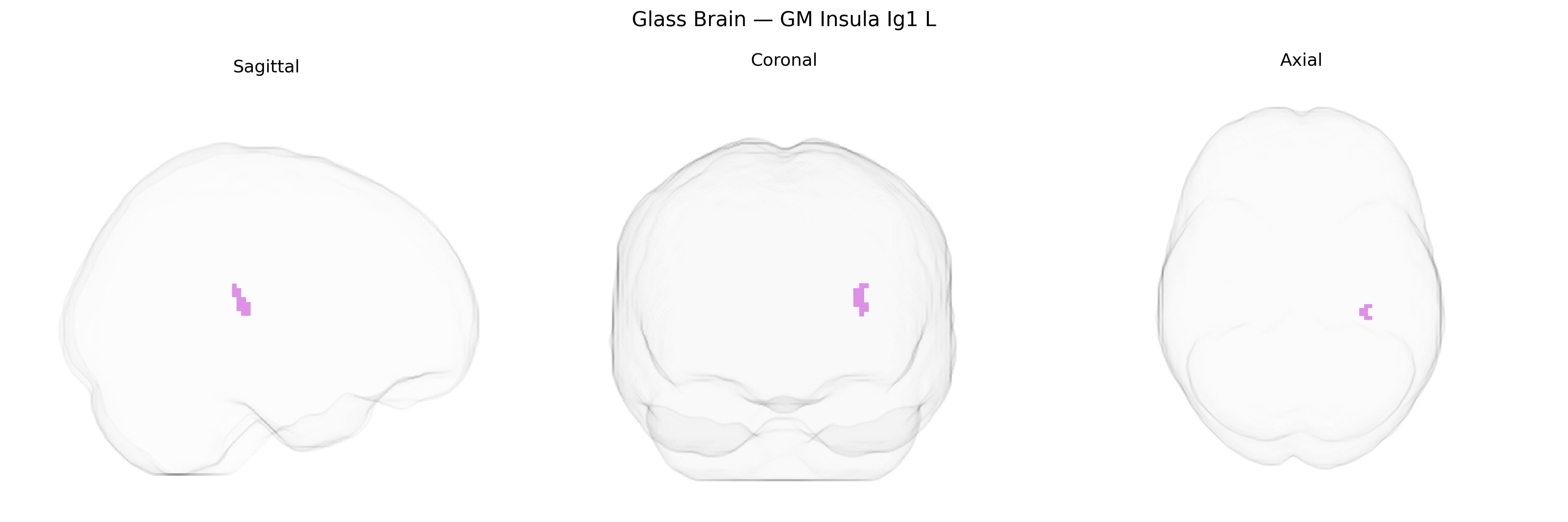 Triplanar Ghost Brain