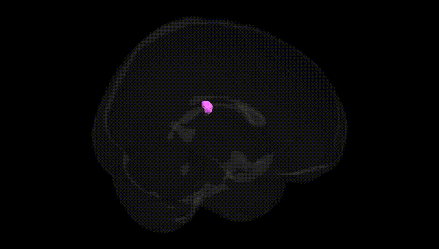 Full Brain Black