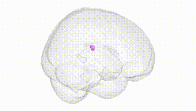 Full Brain White