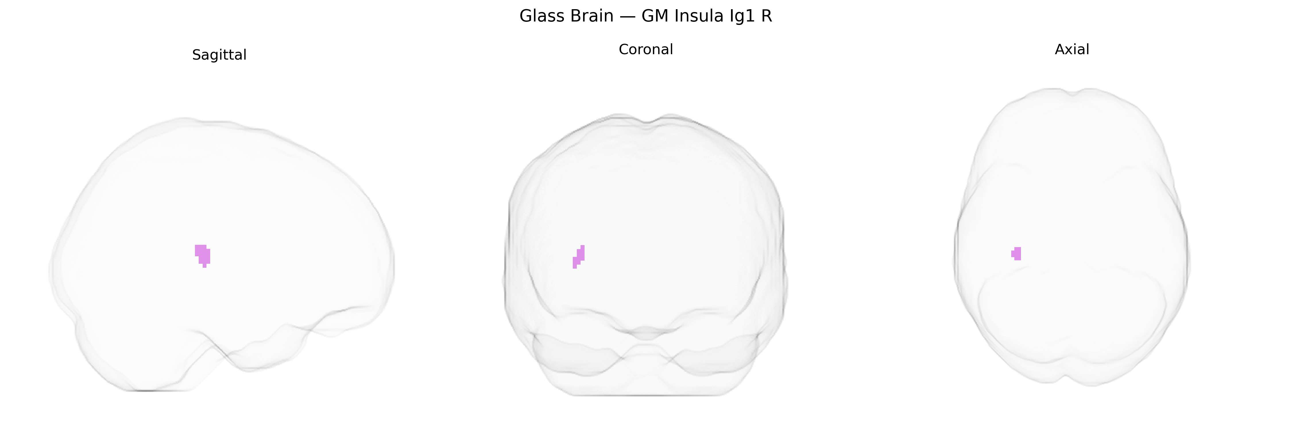 Triplanar Ghost Brain