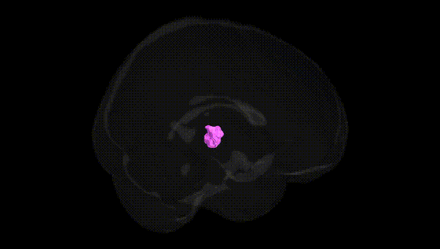 Full Brain Black