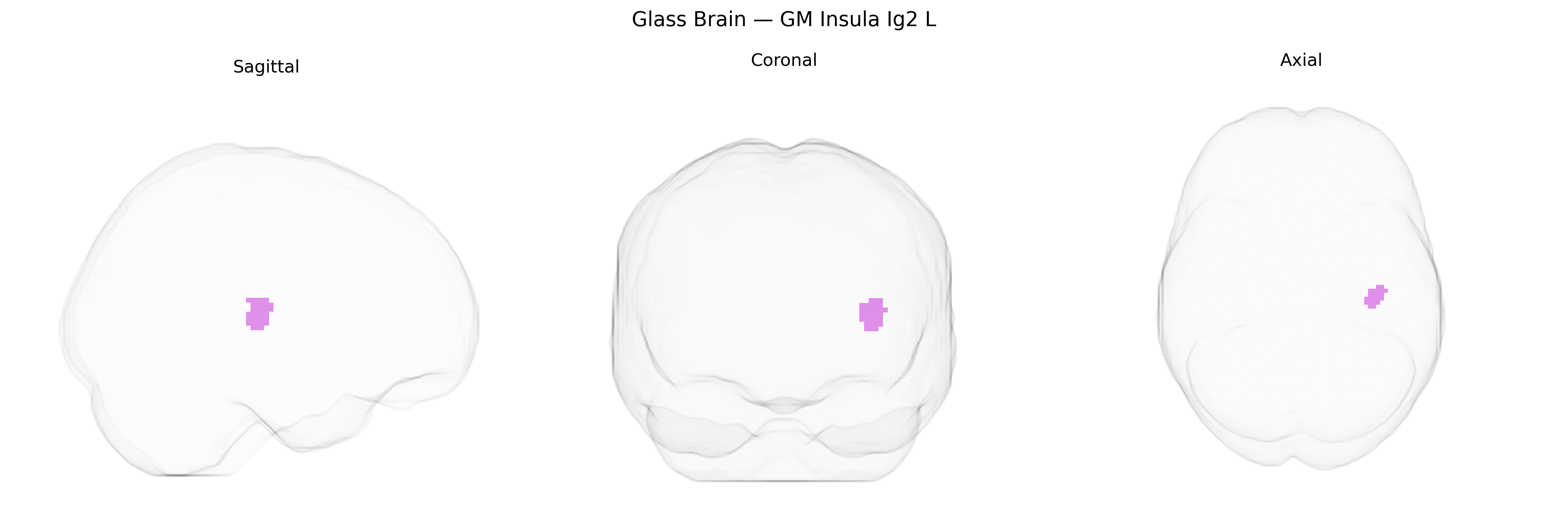 Triplanar Ghost Brain