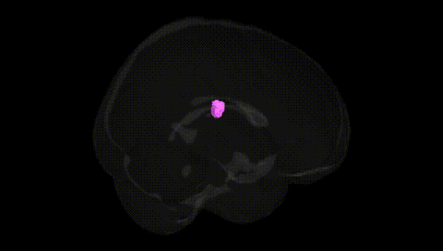 Full Brain Black