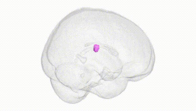Full Brain White
