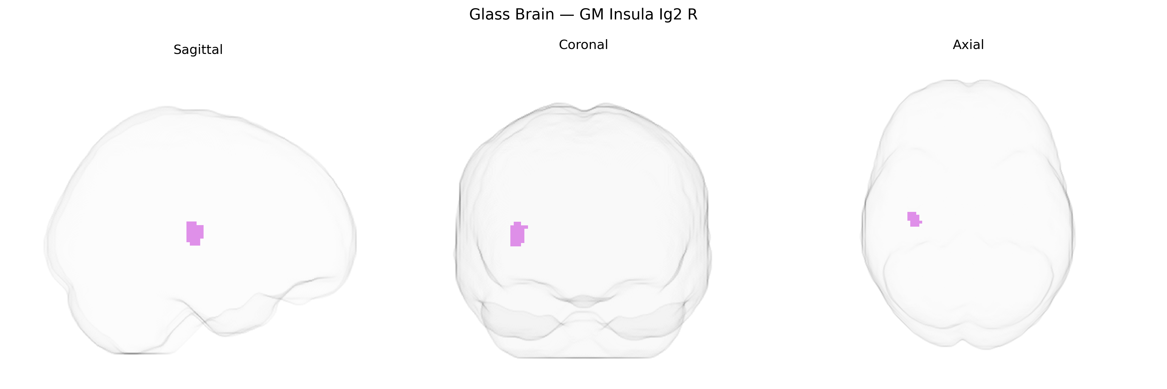 Triplanar Ghost Brain