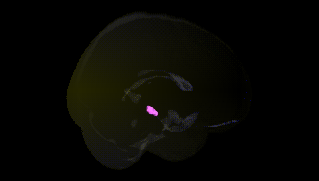 Full Brain Black