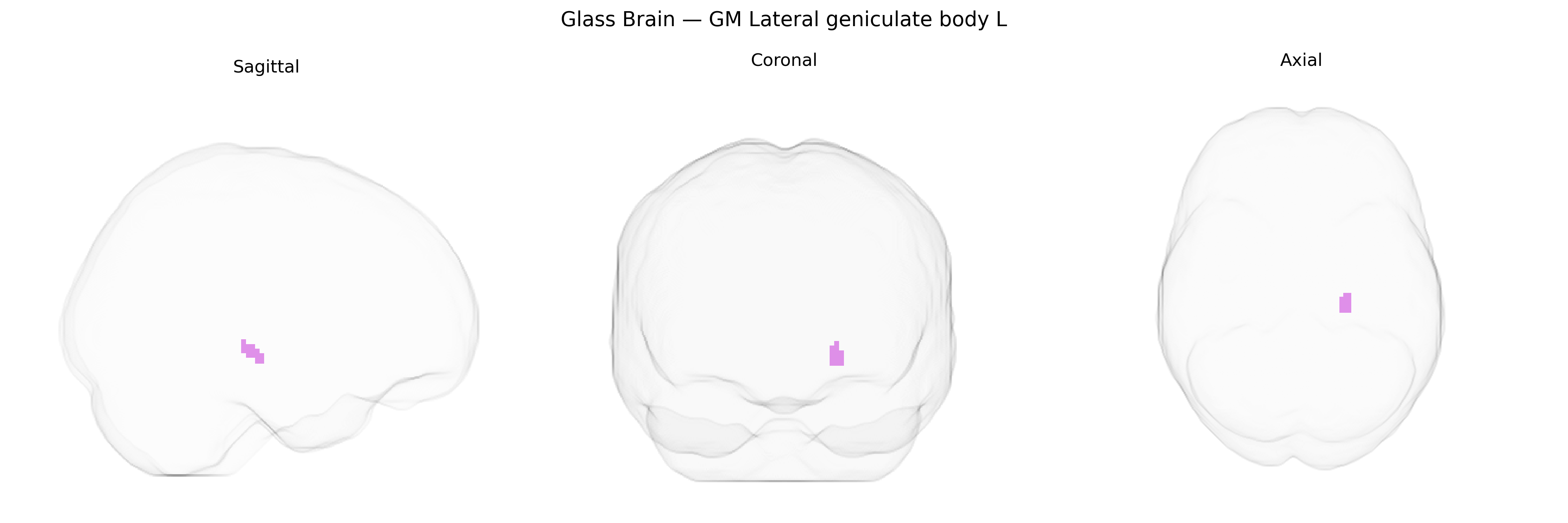 Triplanar Ghost Brain