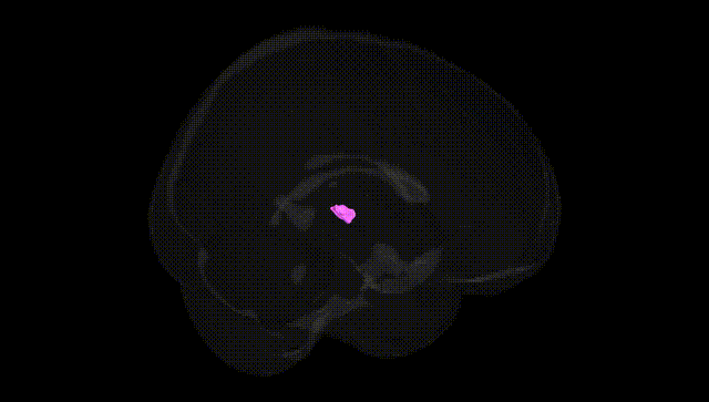 Full Brain Black