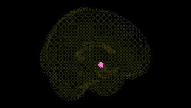 Full Brain Black