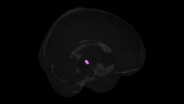 Full Brain Black
