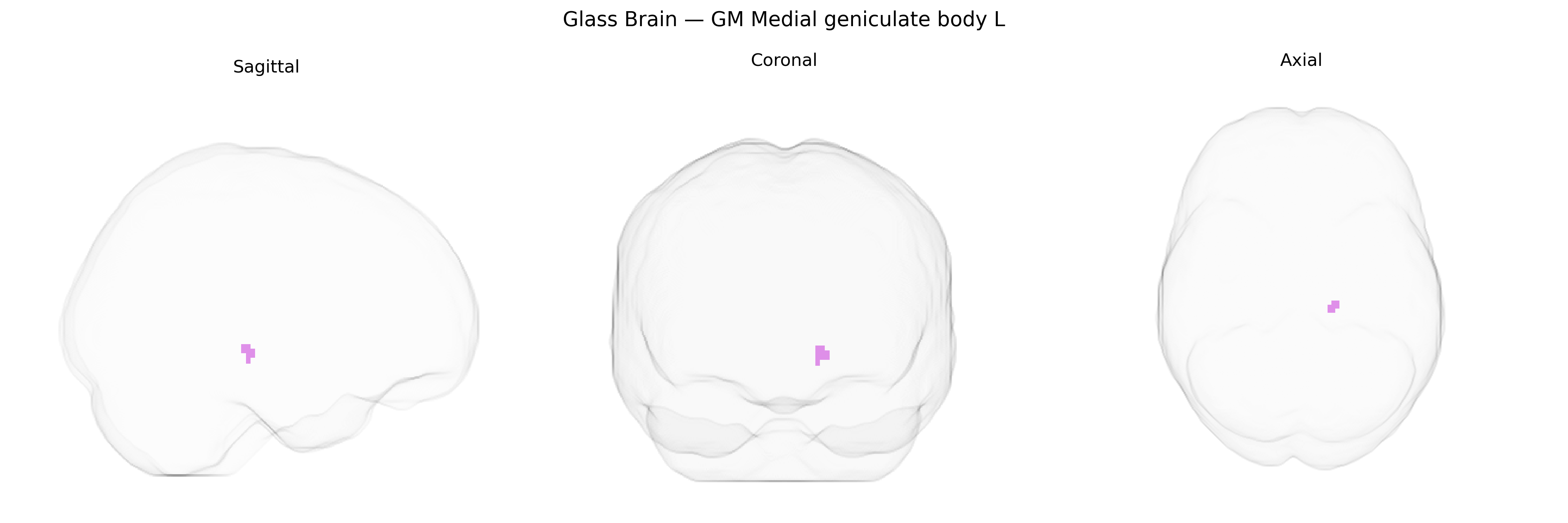 Triplanar Ghost Brain