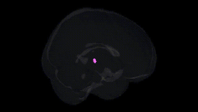 Full Brain Black