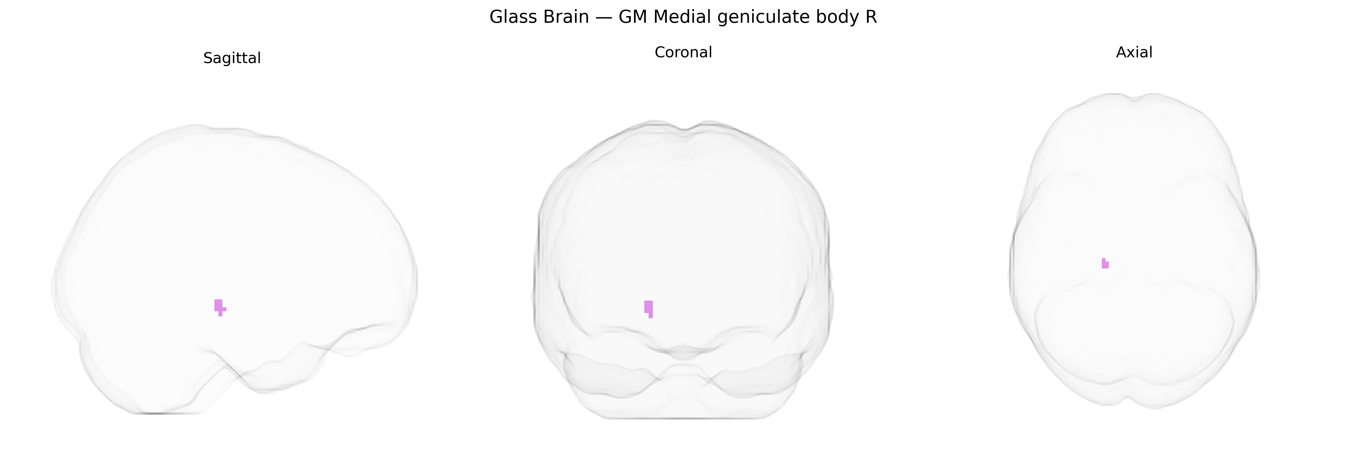 Triplanar Ghost Brain