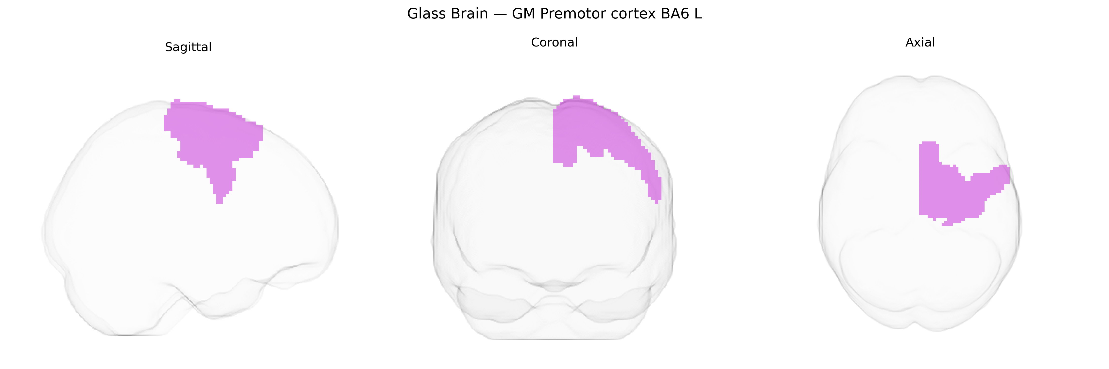 Triplanar Ghost Brain