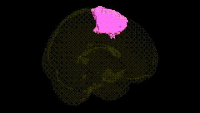 Full Brain Black