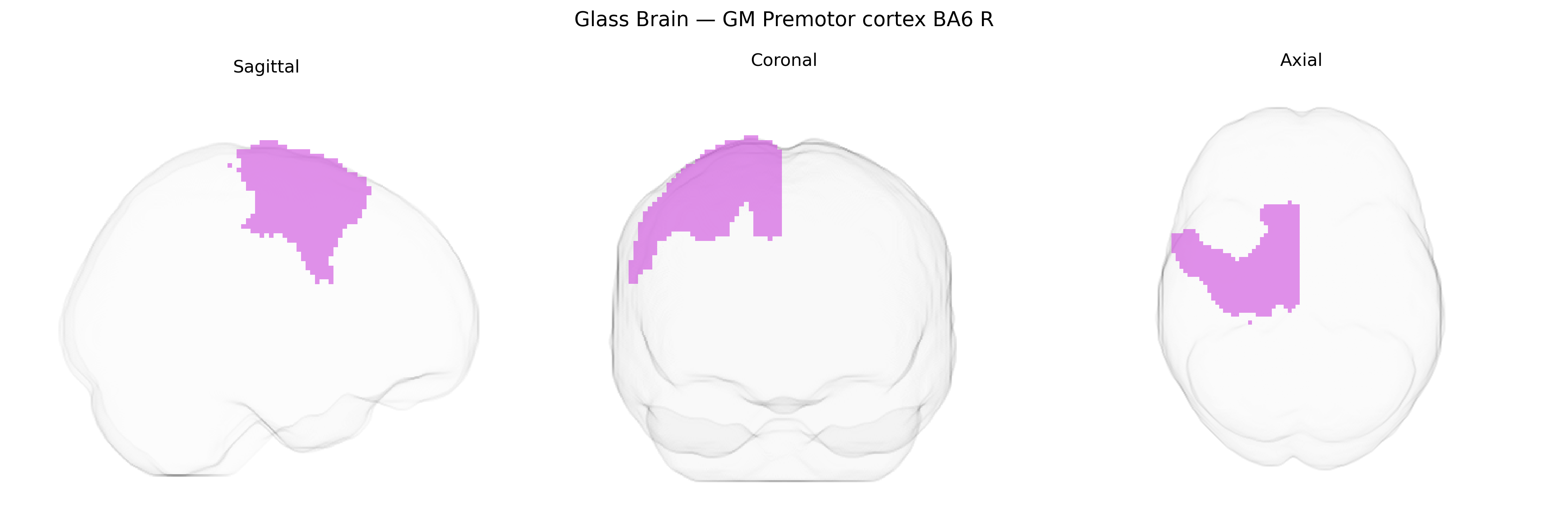 Triplanar Ghost Brain