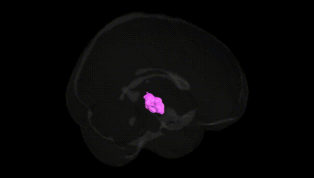 Full Brain Black
