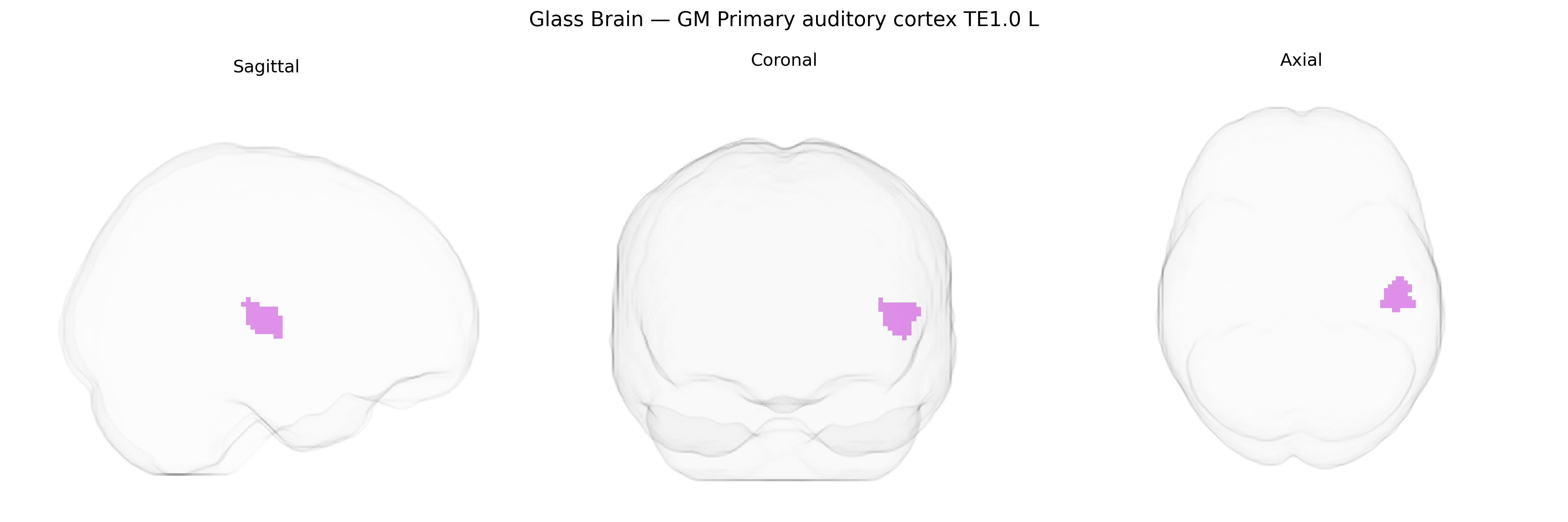 Triplanar Ghost Brain