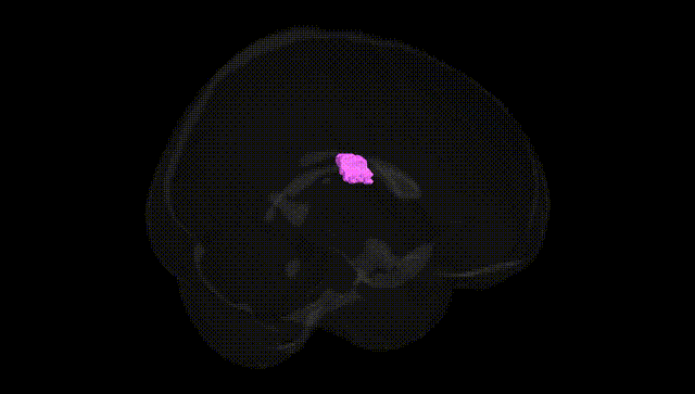 Full Brain Black