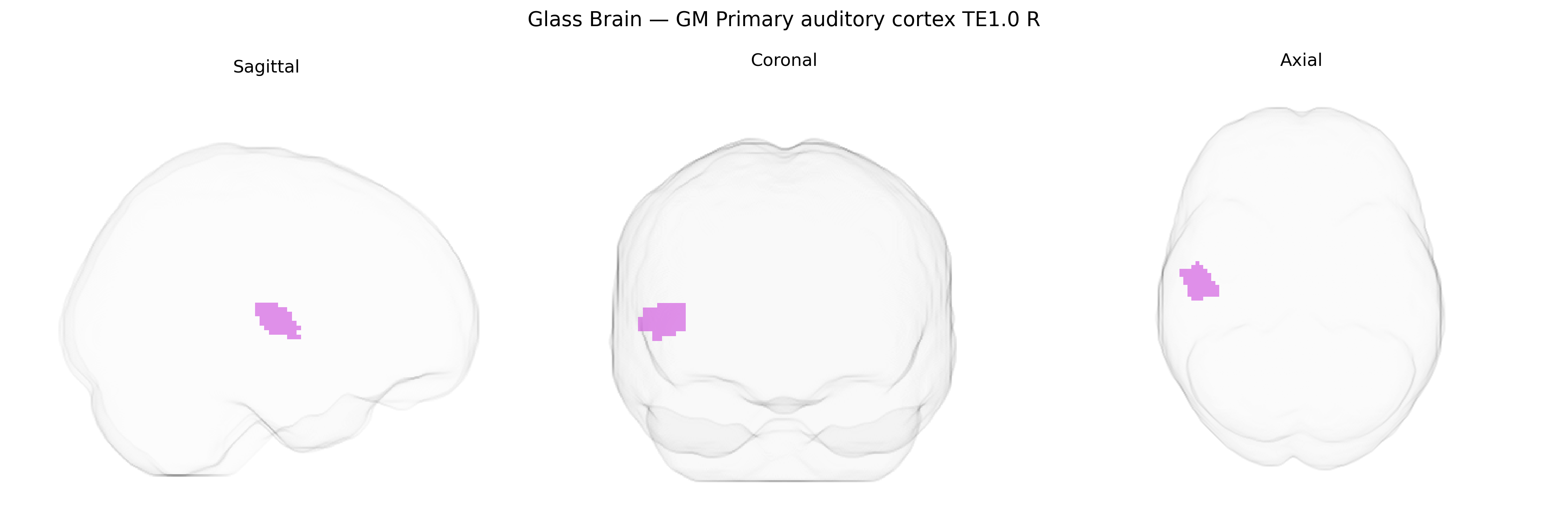 Triplanar Ghost Brain