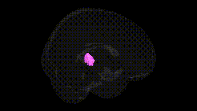 Full Brain Black