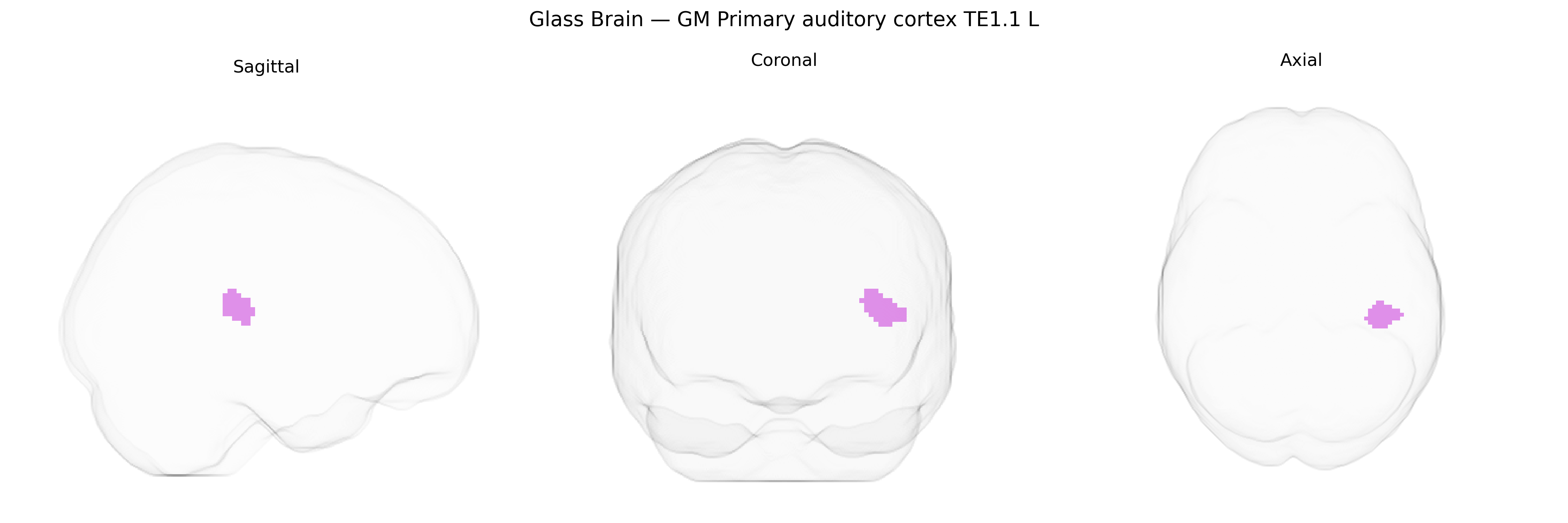 Triplanar Ghost Brain