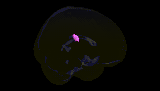 Full Brain Black