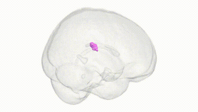 Full Brain White