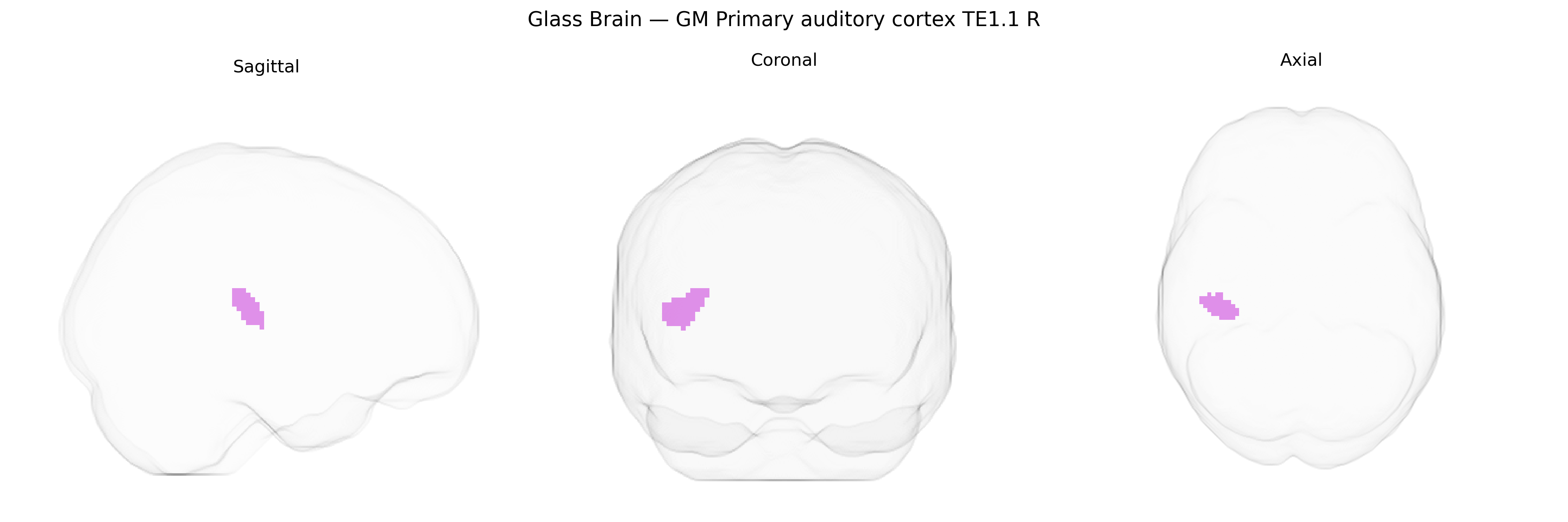 Triplanar Ghost Brain
