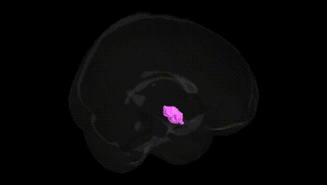 Full Brain Black