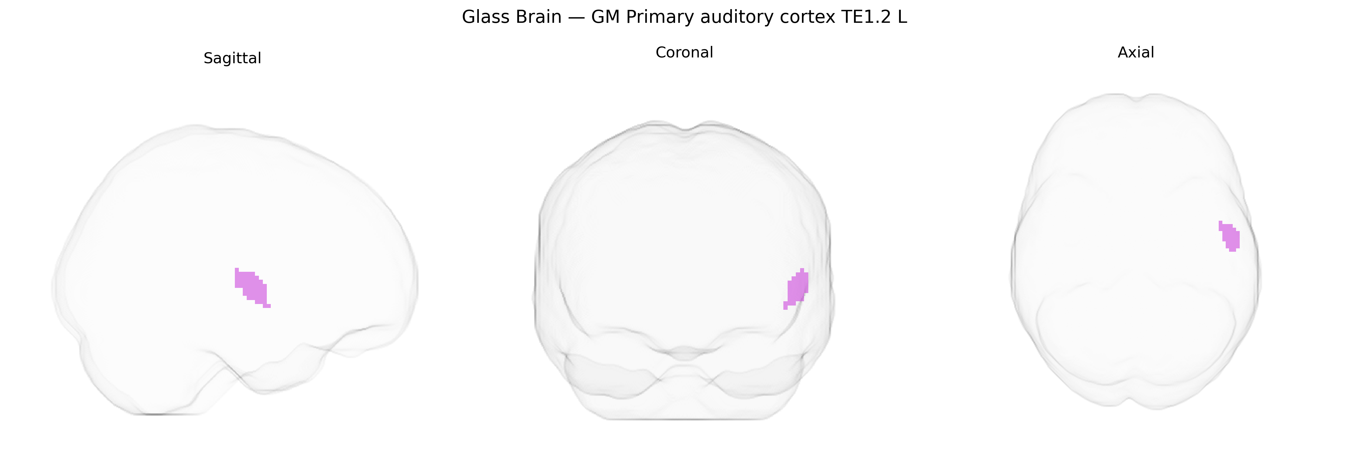 Triplanar Ghost Brain