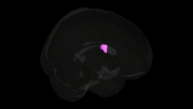 Full Brain Black