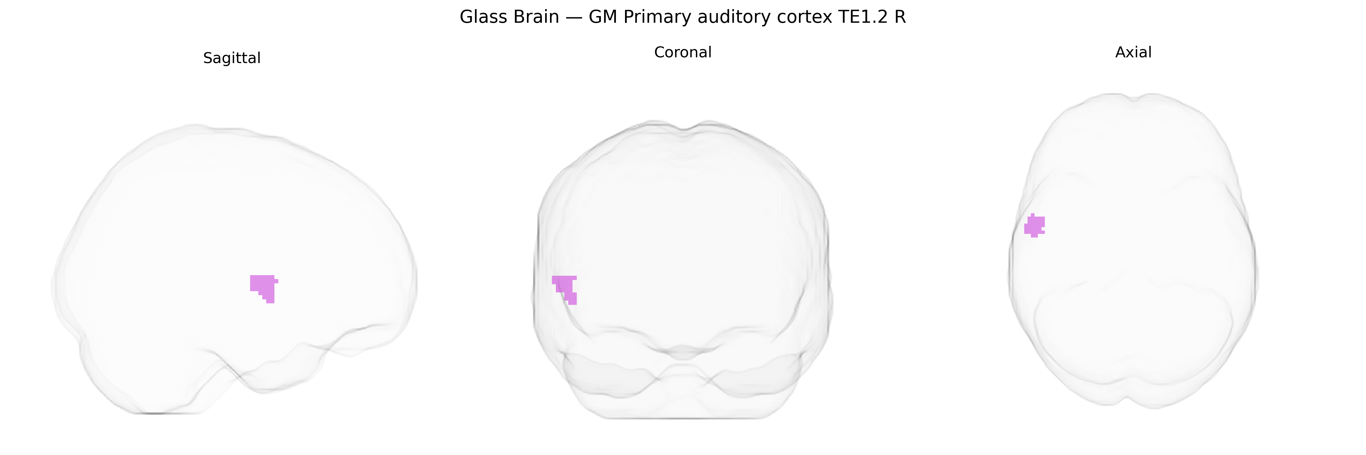 Triplanar Ghost Brain
