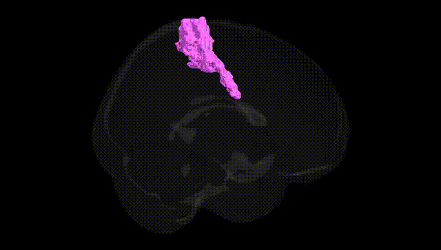 Full Brain Black