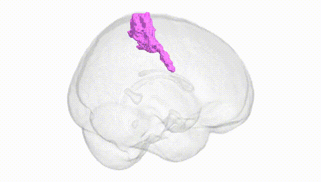 Full Brain White