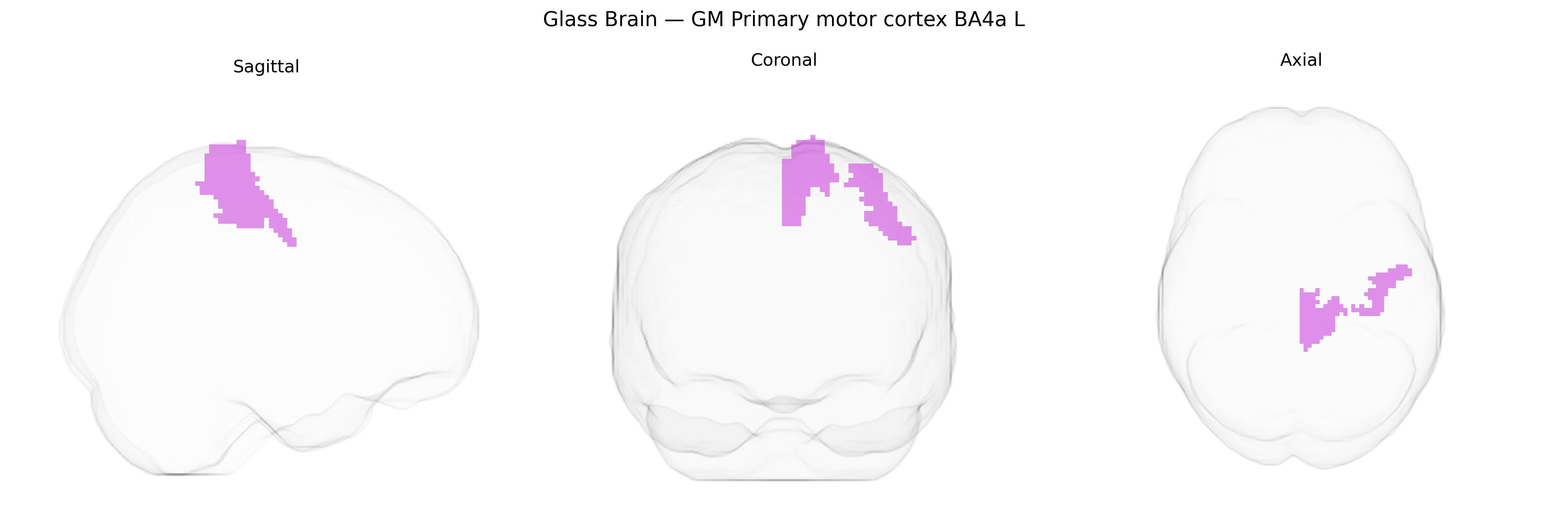Triplanar Ghost Brain