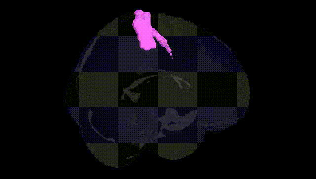 Full Brain Black