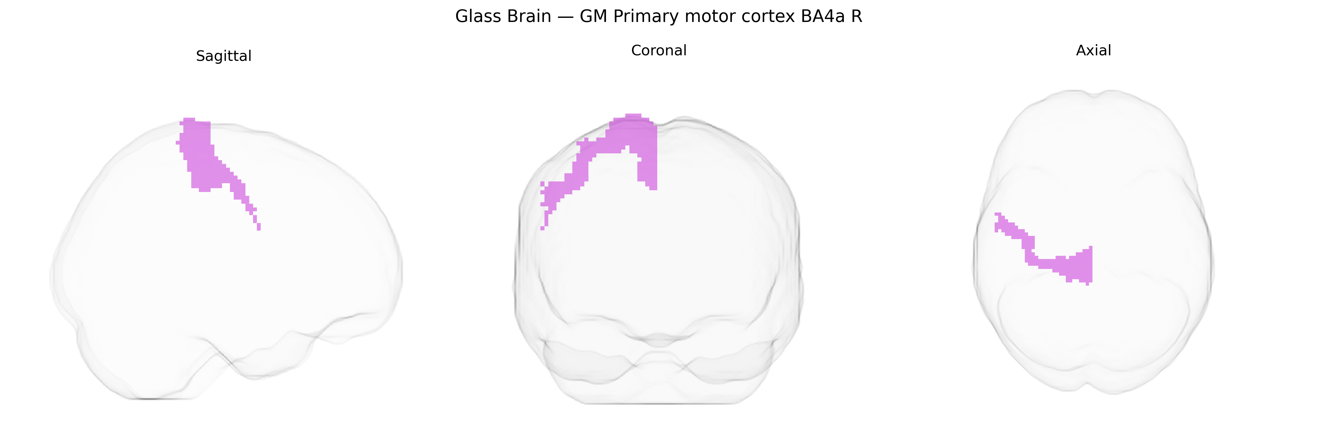 Triplanar Ghost Brain