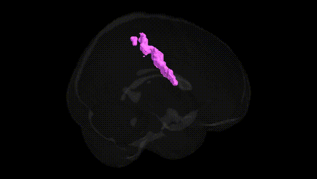 Full Brain Black