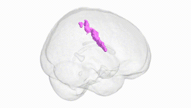 Full Brain White