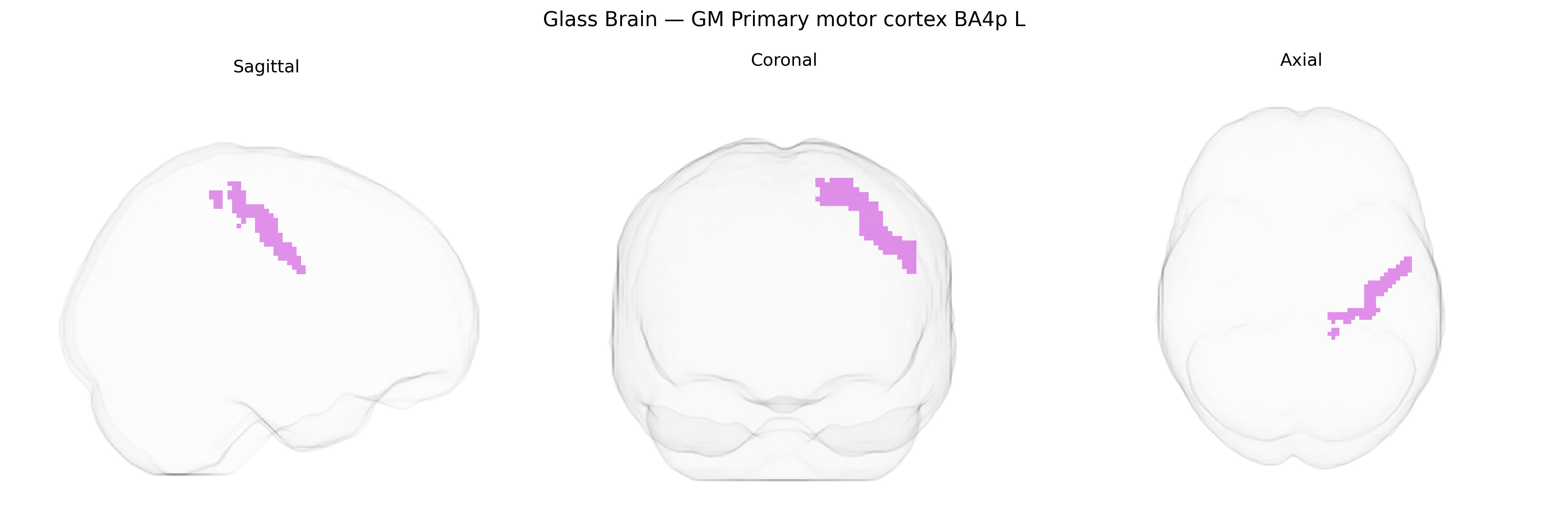 Triplanar Ghost Brain