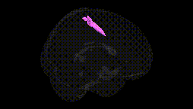 Full Brain Black