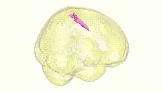 Full Brain White
