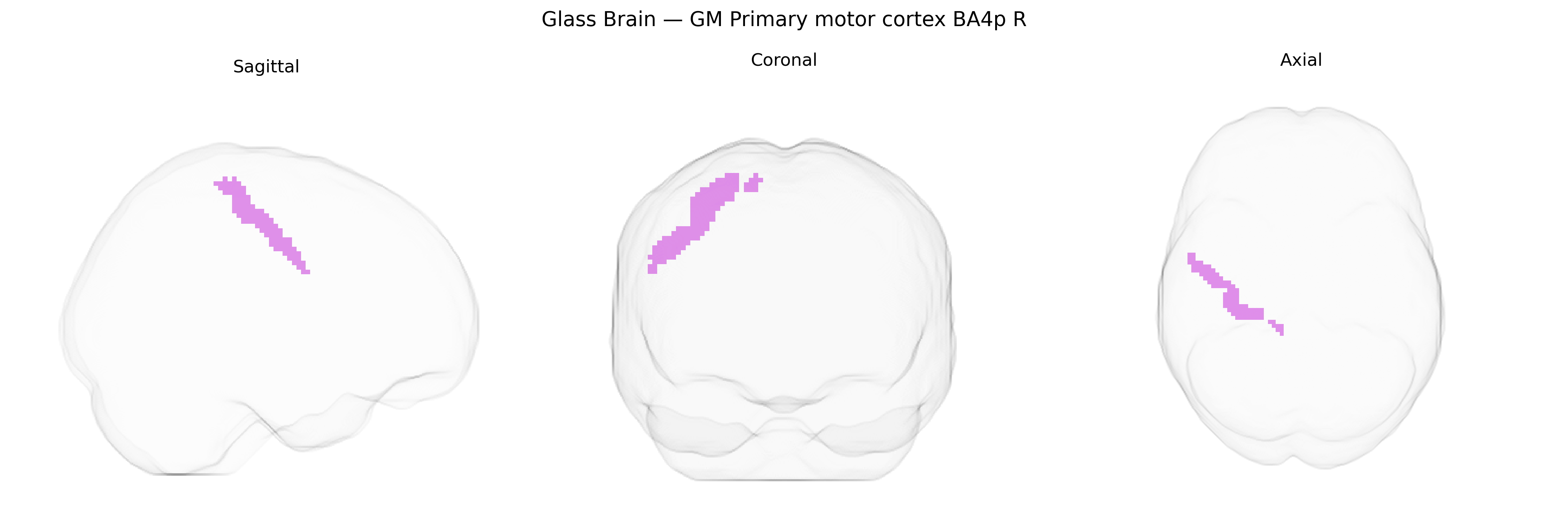 Triplanar Ghost Brain
